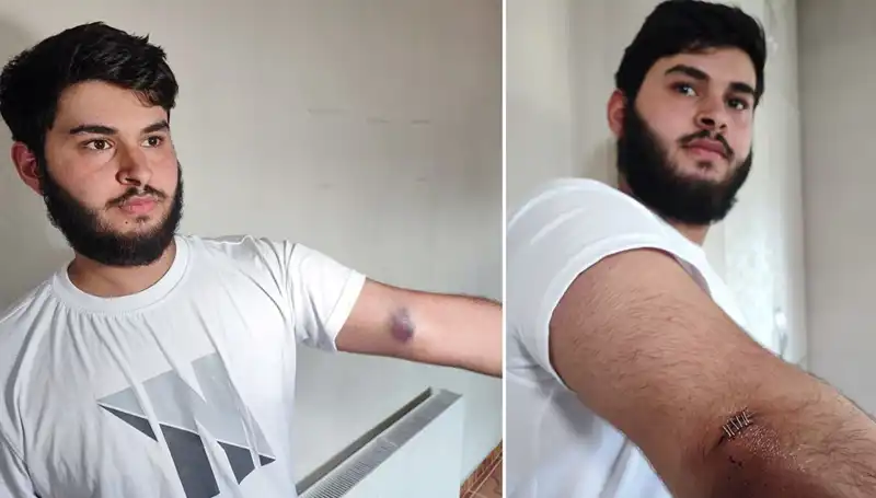 Bahçeye Kaçan Topun Ardındaki Olay: Mahallede Neler Oldu?